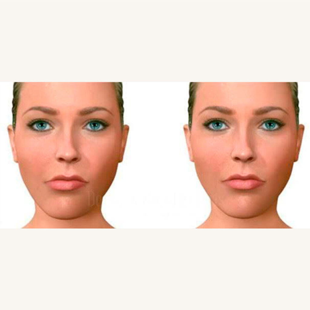 instituto da face campinas Cirurgia ortognática Cirurgias estéticas da face Próteses faciais