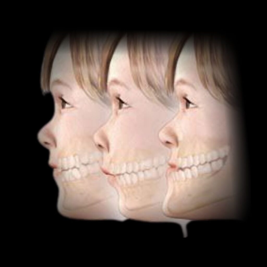 Cirurgia Bucomaxilofacial e Estética Facial