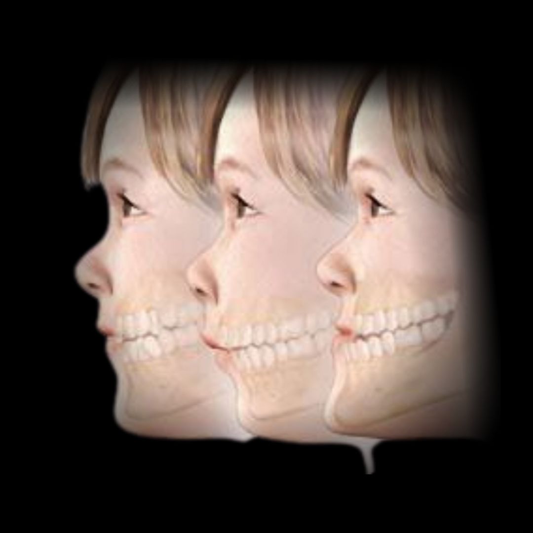 Cirurgia Bucomaxilofacial e Estética Facial